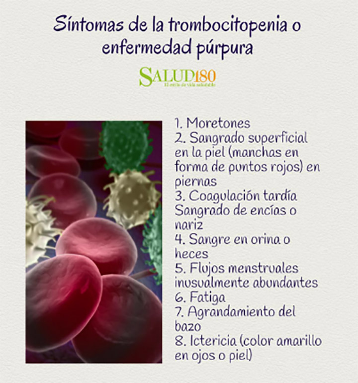 Nombre:  enfermedad-actriz.jpg
Visitas: 106
Tama�o: 146.0 KB